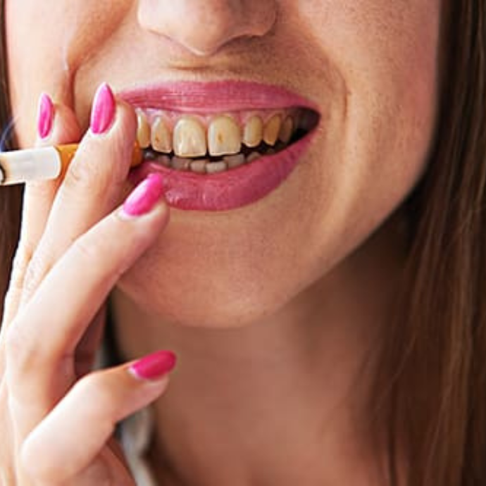 Reduce Tobacco Consumption for health of teeth