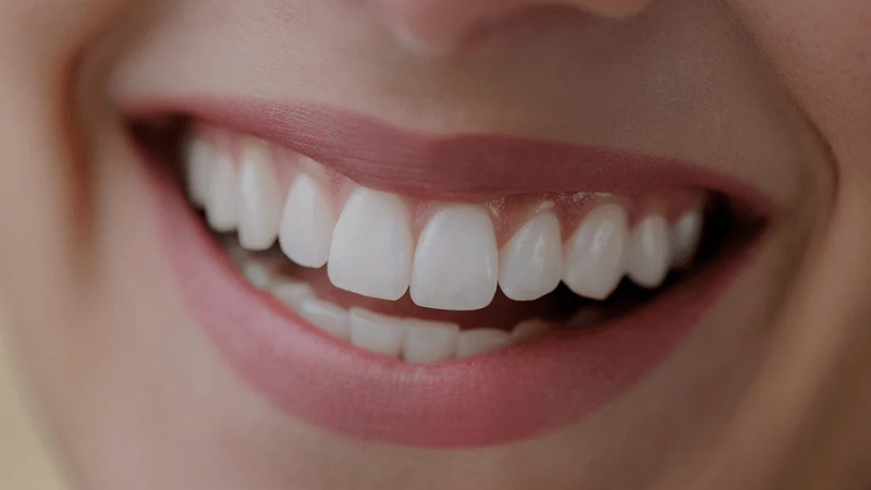 His Teeth Might Turn Into Stones? Here’s Everything You Need To Know by Prodentim